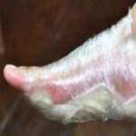 egeszseges-akarsz-lenni-tegy-hagymapakolast-a-labaidra