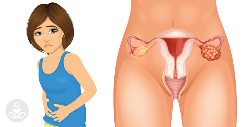 petefészekrák mik a tünetek a nemi szerveken található papillómák gyógyszere